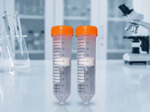 Ion Exchange Chromatography 